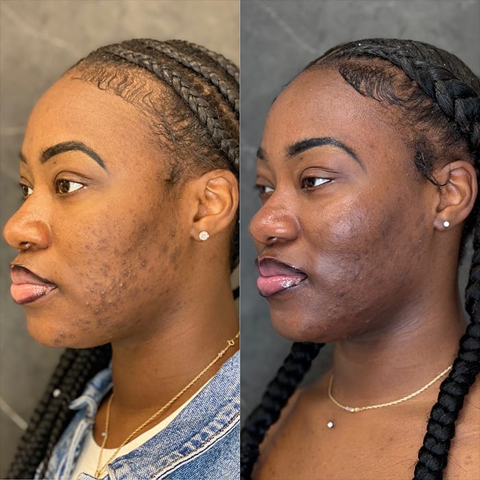 skinology chemical peels 1